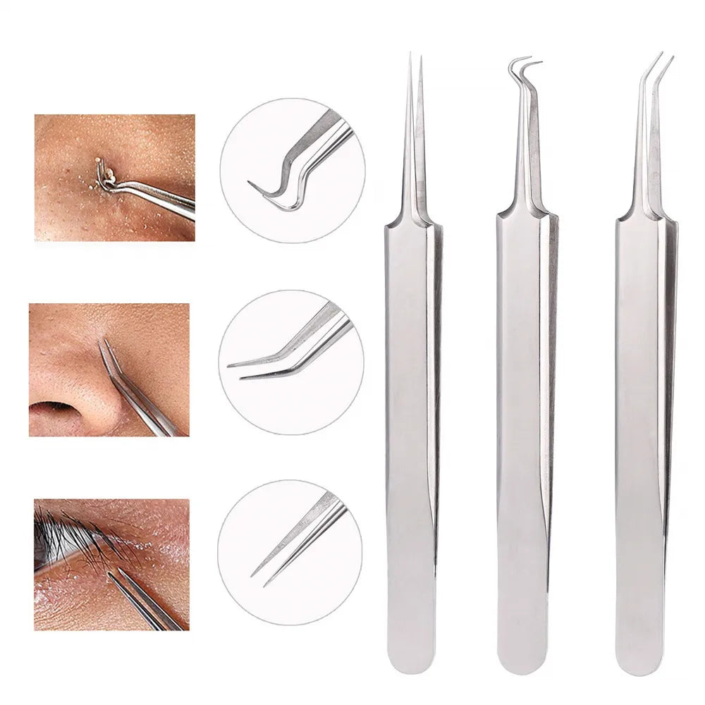 German Ultra-Fine No. 5 Blackhead Tweezers – Precision Acne & Pimple Extractor for Professional Beauty Care