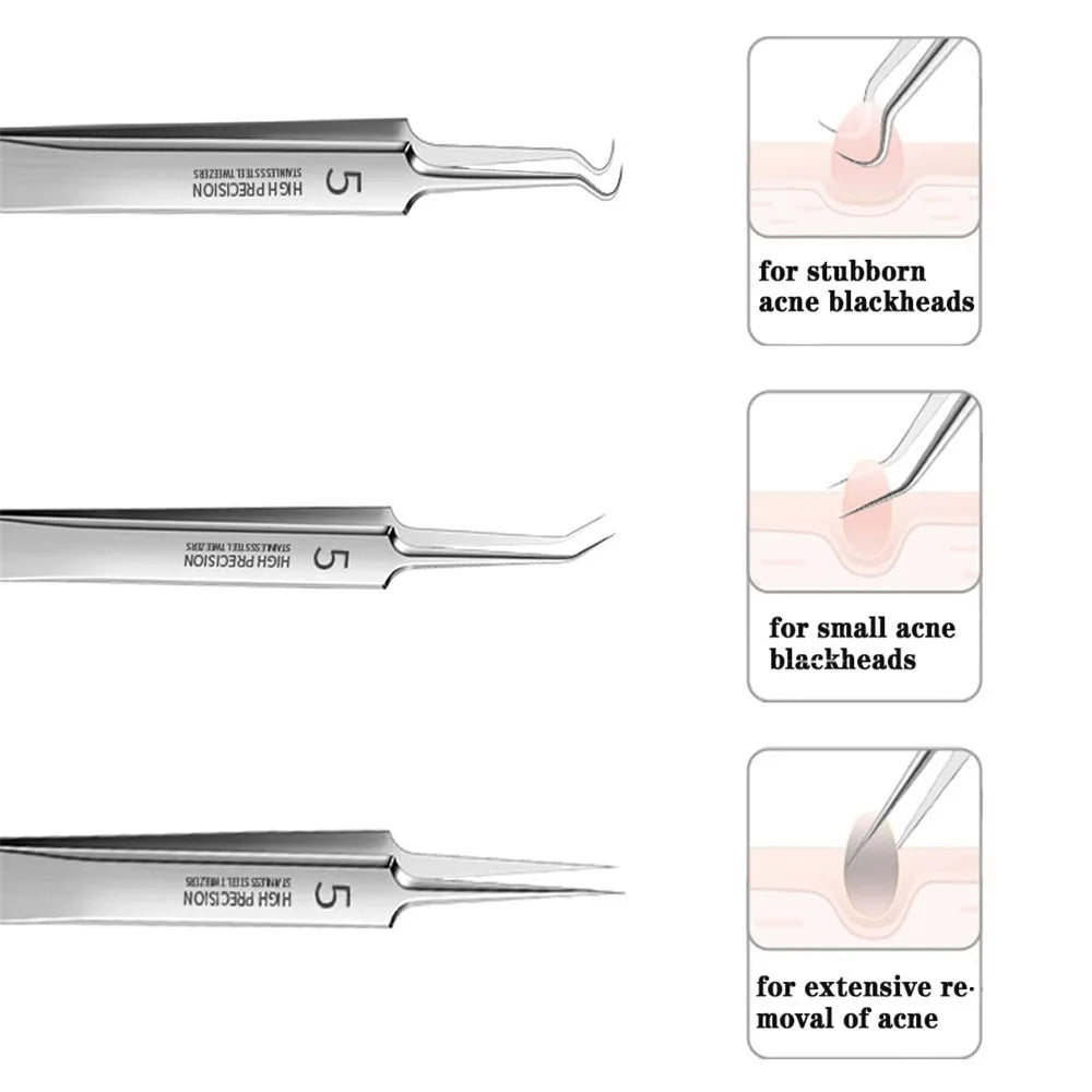 German Ultra-Fine No. 5 Blackhead Tweezers – Precision Acne & Pimple Extractor for Professional Beauty Care