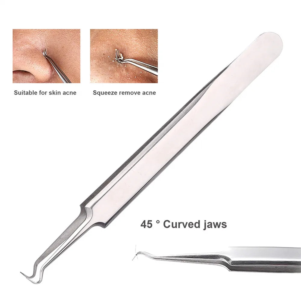 German Ultra-Fine No. 5 Blackhead Tweezers – Precision Acne & Pimple Extractor for Professional Beauty Care