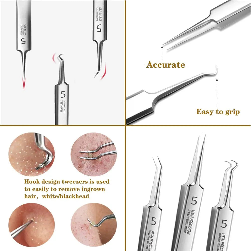 German Ultra-Fine No. 5 Blackhead Tweezers – Precision Acne & Pimple Extractor for Professional Beauty Care