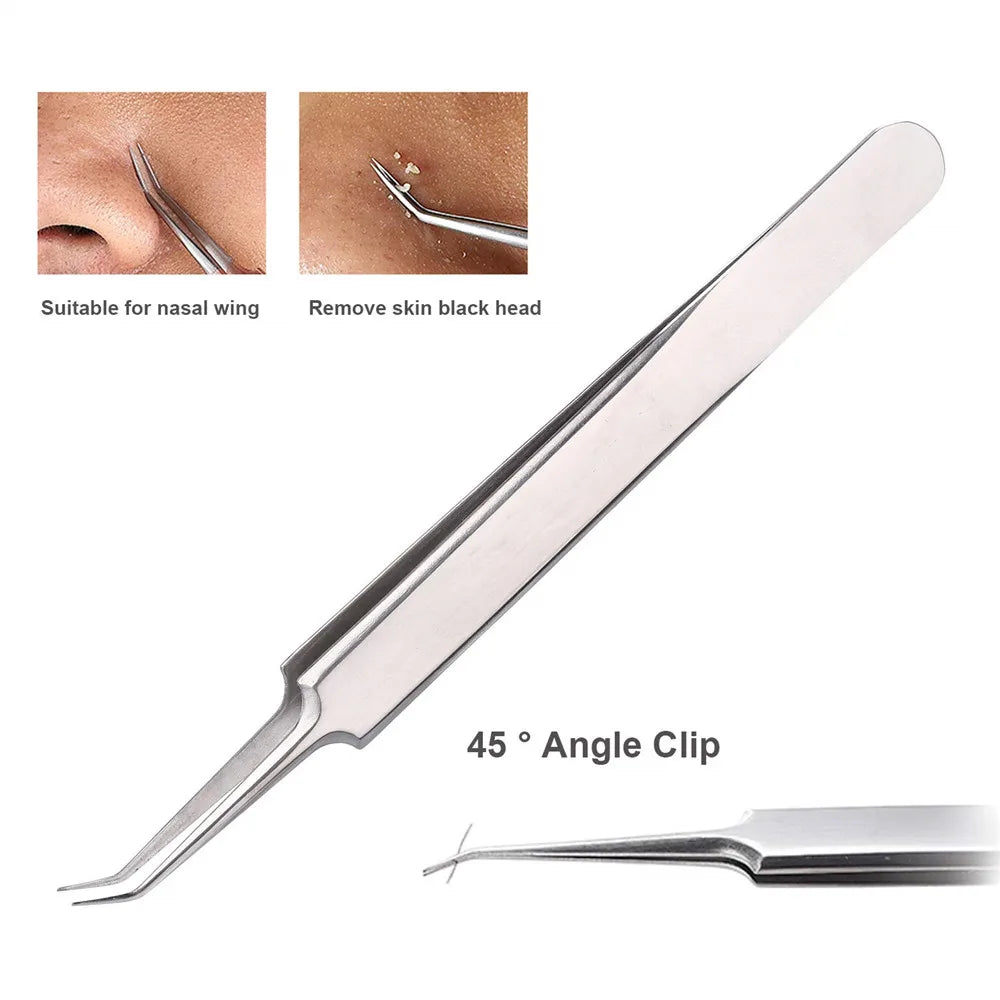German Ultra-Fine No. 5 Blackhead Tweezers – Precision Acne & Pimple Extractor for Professional Beauty Care