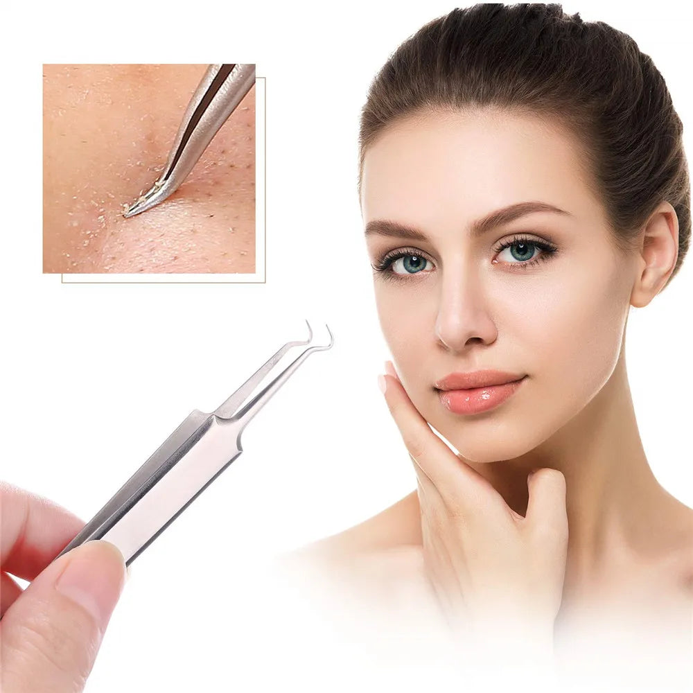 German Ultra-Fine No. 5 Blackhead Tweezers – Precision Acne & Pimple Extractor for Professional Beauty Care
